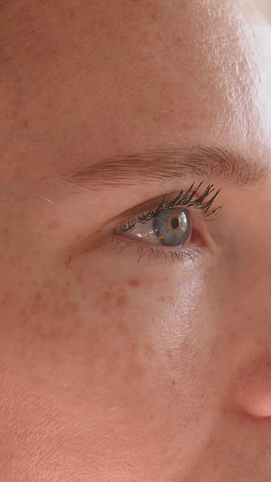CREMA DESPIGMENTANTE PARA MELASMA Y PAÑO